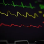 How Cuffless Blood Pressure Monitors Are Reshaping Wellness in Real Estate